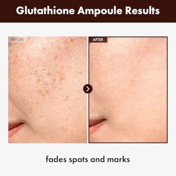 TOSOWOONG Glutathione Serum with 20,000ppm Glutathione, Niacinamide and hyaluronic acid, Dark Spot, Improve skin elasticity, Revitalize complexion, Korean Skincare, 30ml, 1.01 fl. oz.